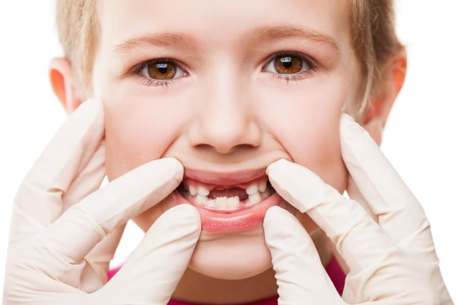 The Role of Pediatric Dentists in Preventing Tooth Decay in Children