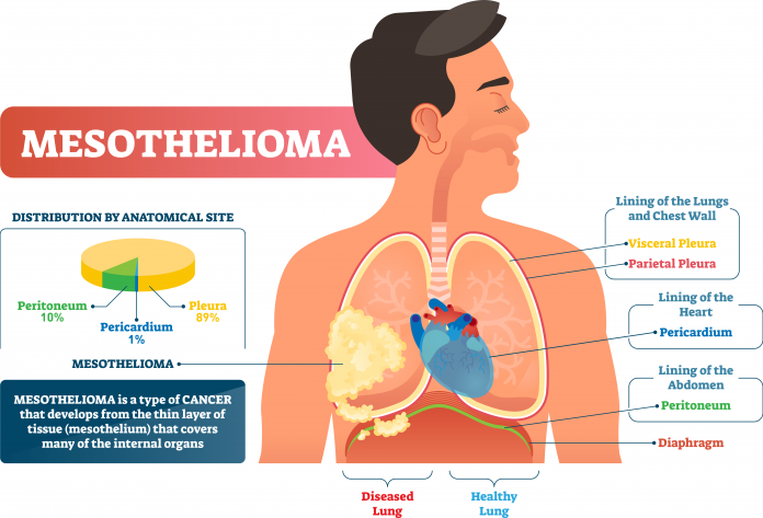 The Legal Implications of Asbestos Exposure