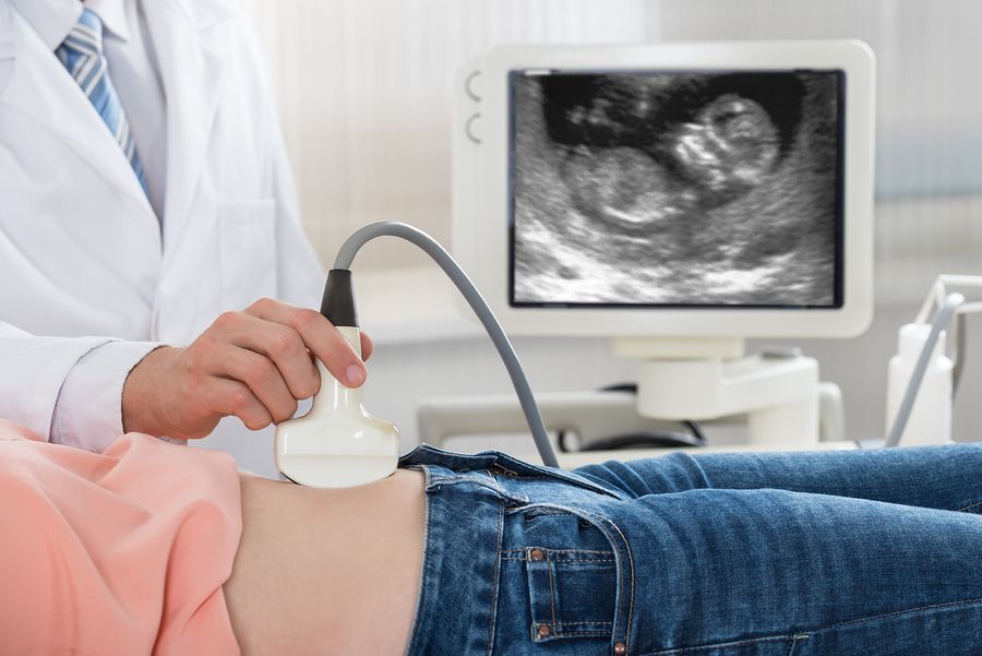 Finding the Best Early Baby Scan Near You: Tips and Recommendations